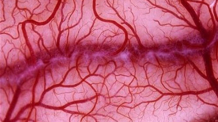 Herkes bilmez! Ar damarı bakın neredeymiş... 1