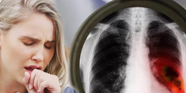 İbn-i Sina'nın yüz yıllar önceki yazdığı reçete: O besinin kabuklarını sakın çöpe atmayın! 9