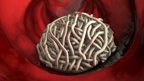 Sağlıklı diye yiyoruz ama bu şekilde tükettiğimizde bağırsaklarda parazite neden oluyor! Yemeden önce tekrar düşünün… 10