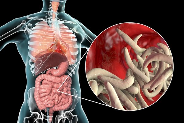 Sağlıklı diye yiyoruz ama bu şekilde tükettiğimizde bağırsaklarda parazite neden oluyor! Yemeden önce tekrar düşünün… 11
