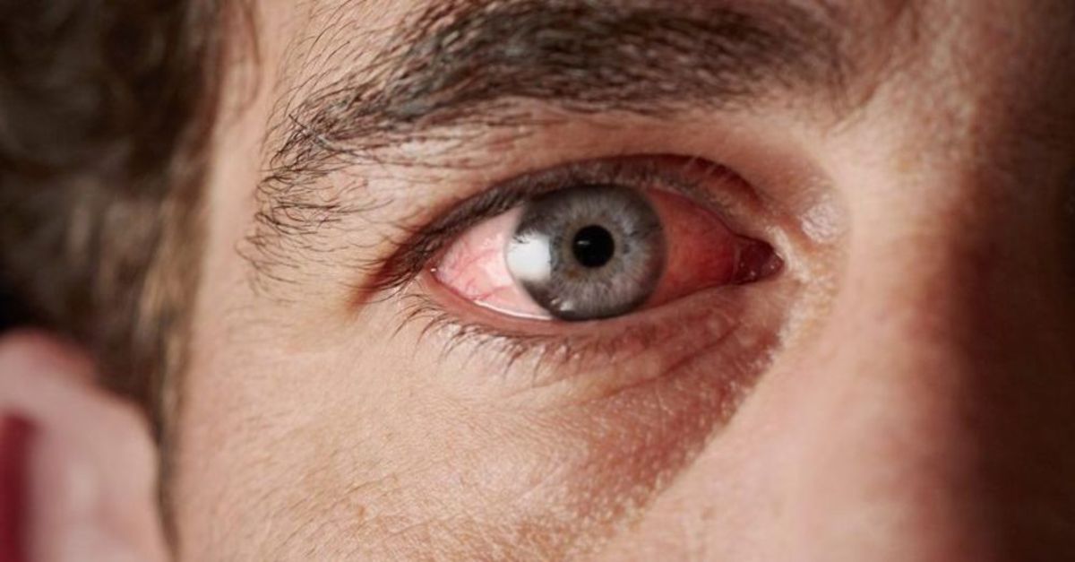 Bu belirtilere çok dikkat edin! Gözünüzün önünde bir şeyler mi uçuşuyor? 8