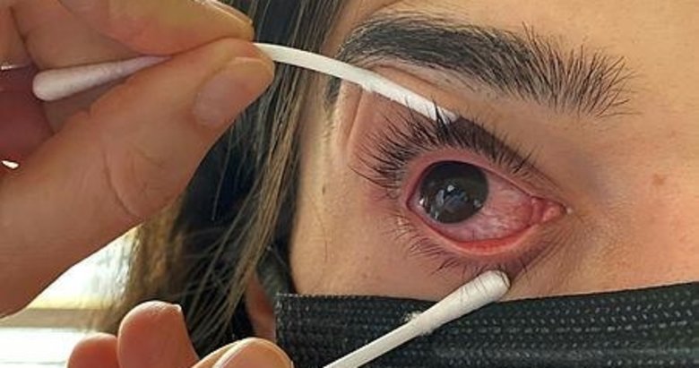 Sıradan gibi duruyor aman dikkat! Görme bozukluğuna sebep oluyor! 10