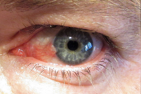 Sıradan gibi duruyor aman dikkat! Görme bozukluğuna sebep oluyor! 3