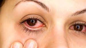 Bu belirtilere çok dikkat edin! Gözünüzün önünde bir şeyler mi uçuşuyor? 3