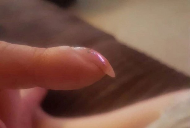 Parmak testiyle akciğer kanseri riskinizi öğrenin! İşte o hayati test... 3