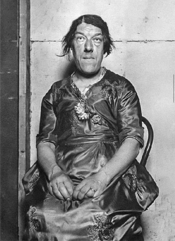 Çocukları için dünyanın en çirkin kadını oldu! Marry Ann Bevan 8