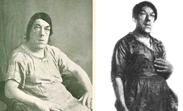 Çocukları için dünyanın en çirkin kadını oldu! Marry Ann Bevan 2