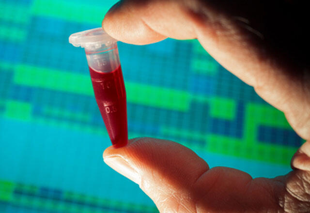 Uzmanlardan şaşırtan açıklama! Bu kan grubuna sahip olanlar bencil oluyor... 5