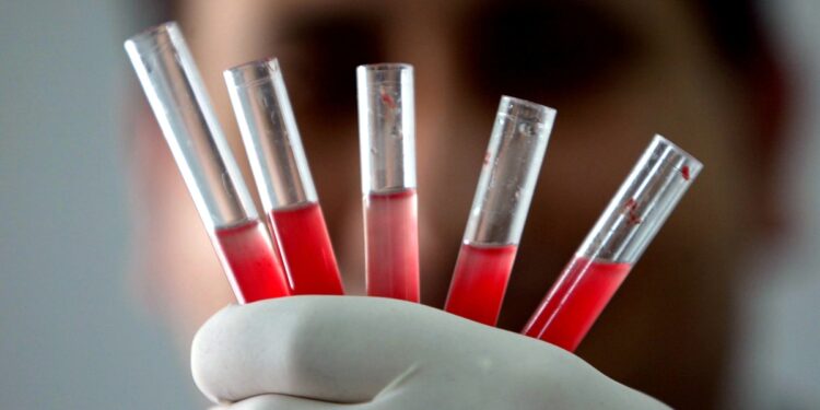 Uzmanlardan şaşırtan açıklama! Bu kan grubuna sahip olanlar bencil oluyor... 6