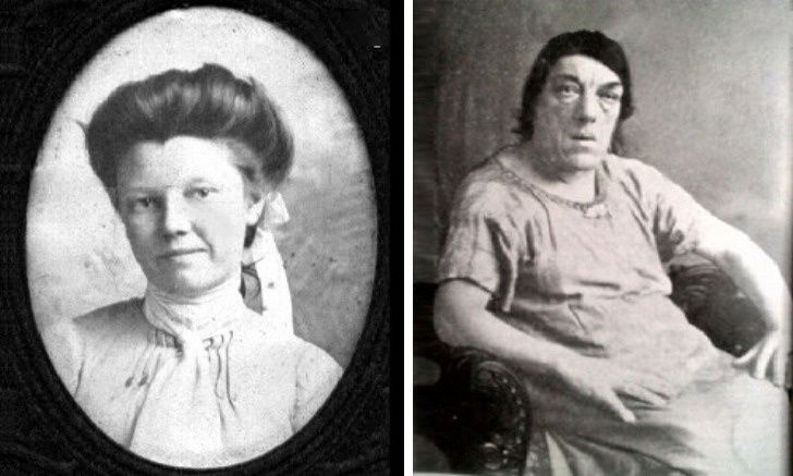 Çocukları için dünyanın en çirkin kadını oldu! Marry Ann Bevan 6