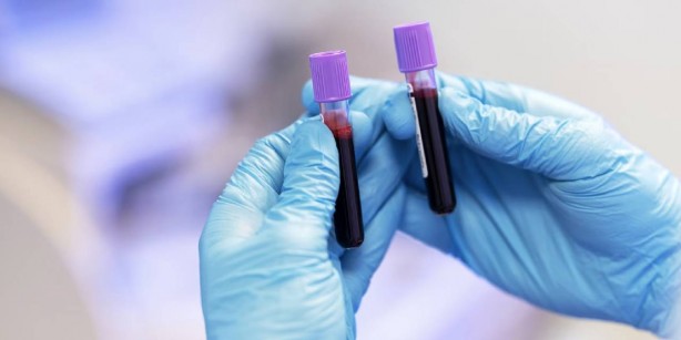 En zeki kan grubu belli oldu! O kana sahip olanların beyni... 5