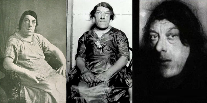 Çocukları için dünyanın en çirkin kadını oldu! Marry Ann Bevan 5