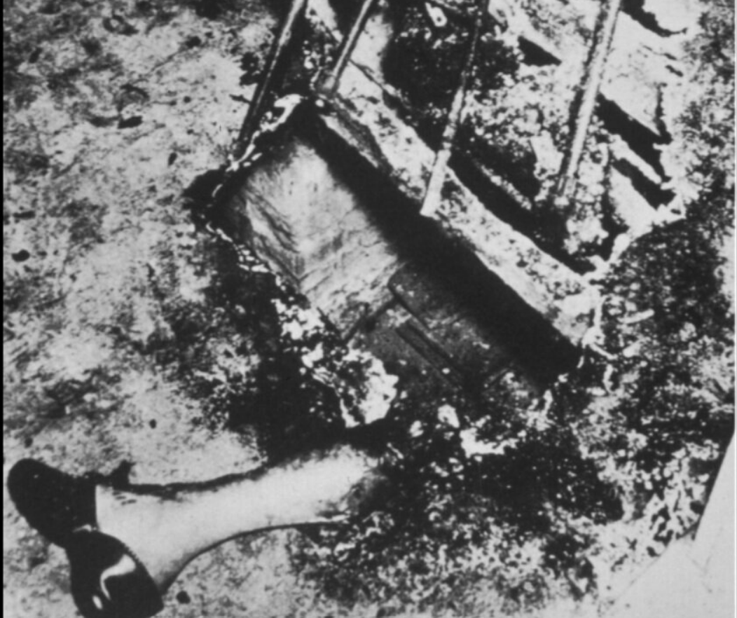 Oturduğu yerde alev alıp küle döndü! Geriye tek kalan yanmamış bacak, sırrı çözülemiyor 11