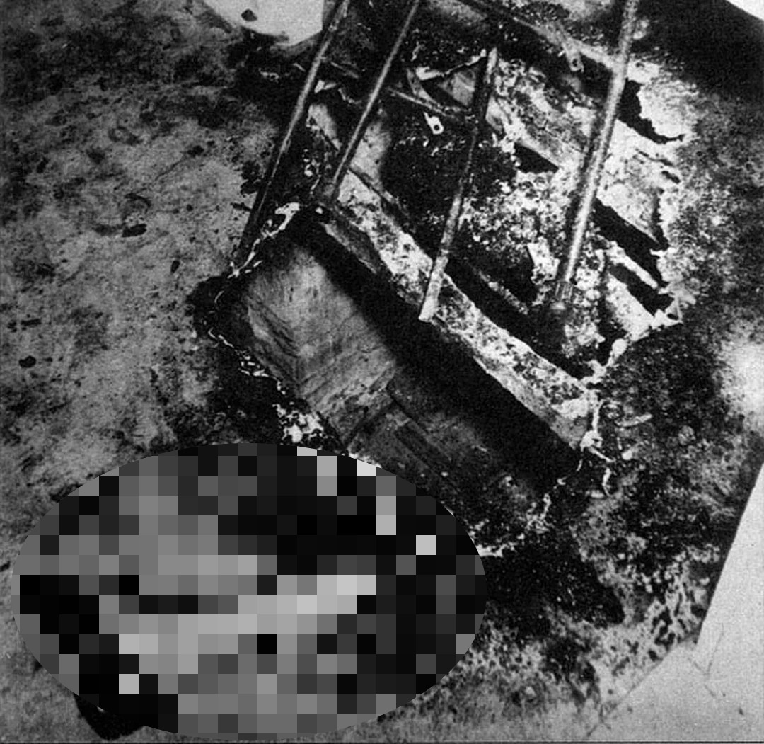 Oturduğu yerde alev alıp küle döndü! Geriye tek kalan yanmamış bacak, sırrı çözülemiyor 4