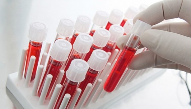 Hastalık onların yanına bile uğramıyor! Bu kan grubundan olanlar adeta… 3