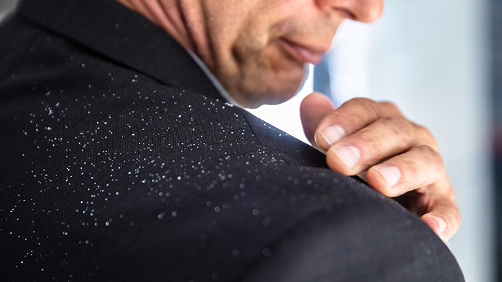 Mutfağınızdaki bu ürün sayesinde kepek sorunu tarihe karışıyor! Mucizevi bir şey! Uygulayanlar, dua edecek 6