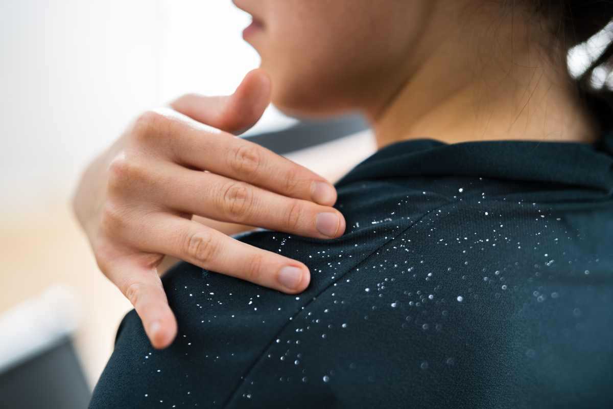 Mutfağınızdaki bu ürün sayesinde kepek sorunu tarihe karışıyor! Mucizevi bir şey! Uygulayanlar, dua edecek 8