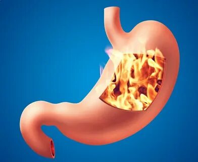 Mide şişkinliği olanlar dikkat! Uzman doktordan flaş açıklama... 1