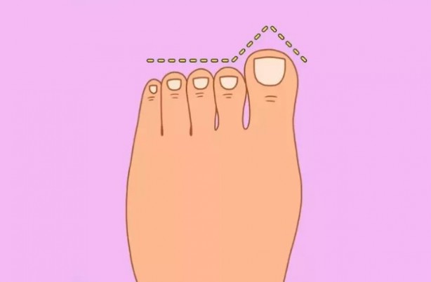 Mısır, Yunan, Alman… Ayak şekliniz hangi milletten olduğunuzu gösteriyor! 7