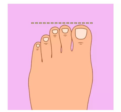 Mısır, Yunan, Alman… Ayak şekliniz hangi milletten olduğunuzu gösteriyor! 4