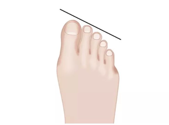 Mısır, Yunan, Alman… Ayak şekliniz hangi milletten olduğunuzu gösteriyor! 3