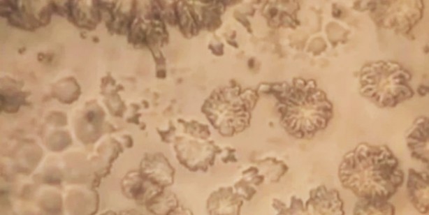 Zemzemi mikroskopta inceleyen genetik mühendisi şaşkına döndü 2