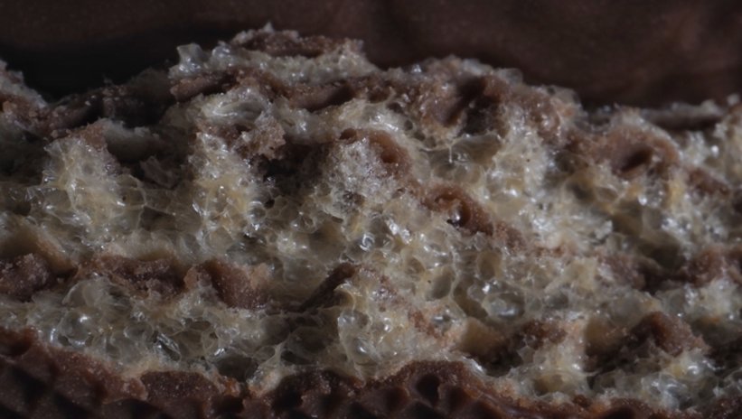 Meğer böbrekleri çürütüyormuş! Severek tükettiğimiz o besin dayanılmaz ağrılara sürüklüyor.... 1