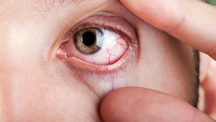 7 yıl önceden ölümcül hastalık sinyalini veriyor! Gözlerinize dikkat... 11