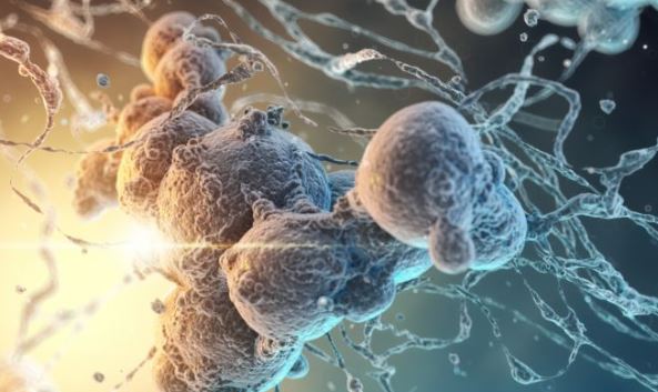 En erken evre kanser belirtileri açıklandı! Zamanlama hayat kurtarıyor 8