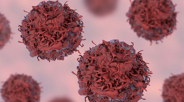 En erken evre kanser belirtileri açıklandı! Zamanlama hayat kurtarıyor 2