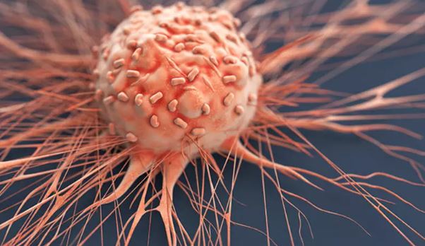 En erken evre kanser belirtileri açıklandı! Zamanlama hayat kurtarıyor 1