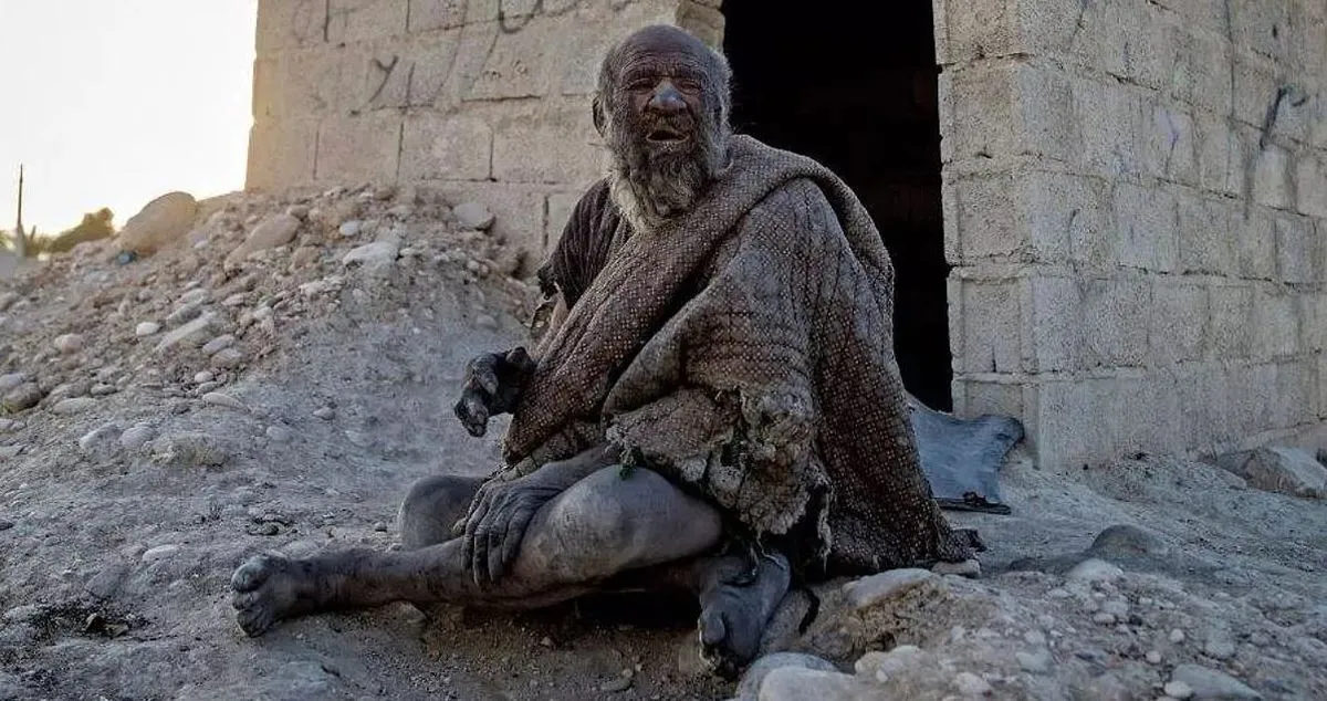 70 yıldır yıkanmayan adam yıkandıktan birkaç ay sonra öldü 11