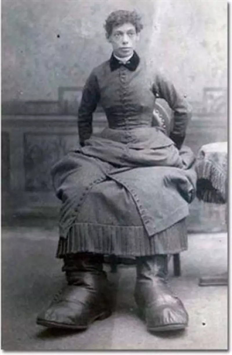 İki yüzlü olarak doğdu! Hayat hikayesi kan donduracak cinsten 12