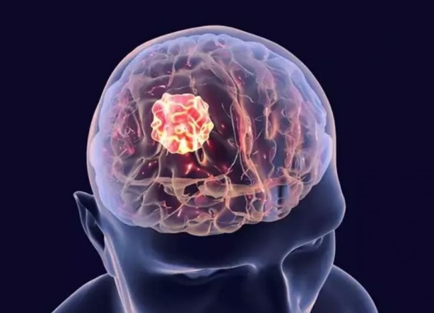 Bu yiyecekler beyin sağlığınızı mahvediyor 2