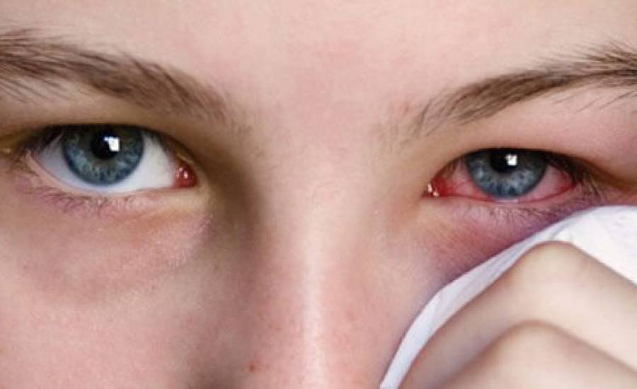 Bu şekilde uyumak görme kaybına yol açıyor! Uzmanı erken teşhis konusunda uyardı... 4