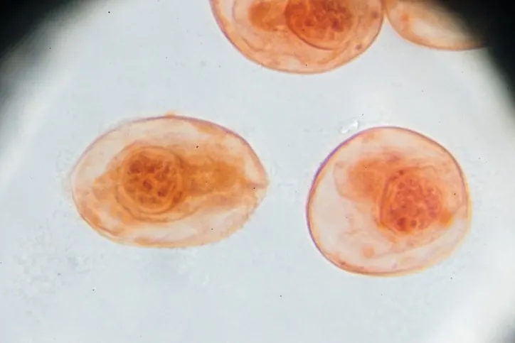 Doktorlar bile şokta! Beyninden ve ciğerlerinden 700 tane kıl kurdu çıkarıldı: O yemek sonunu getiriyordu... 9