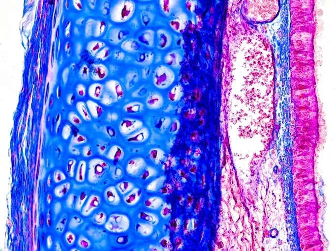 Hapşırığını tutmaya çalıştı nefes borusunu yırttı! Doktorlar bunun bir ‘ilk’ olduğunu söylüyor 3