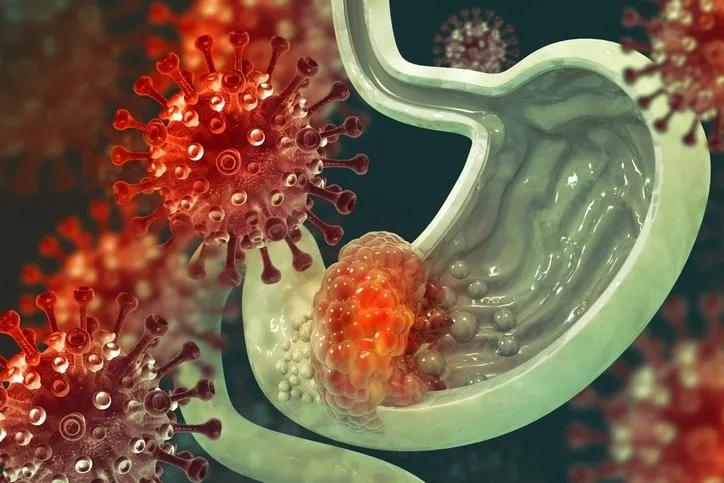 Mide ekşimesi sandığınız kalp krizinin habercisi olabilir! Eğer bu belirtiler eşlik ediyorsa… 4