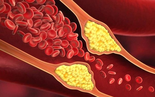Binlerce insan çare arıyordu! Kolesterolü tek seferde şifalandıran besin sonunda bulundu! 10