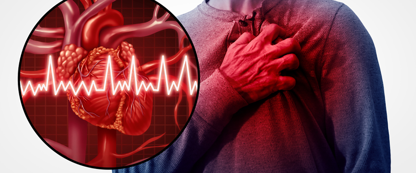 Kalp krizine müdahalede "altın zaman"! Kanserden 2 kat fazla görülüyor... 5