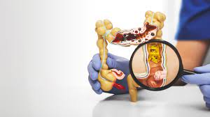 Kanserden kan şekerine... Şifa deposu bu yiyeceğin faydası saymakla bitmiyor 8