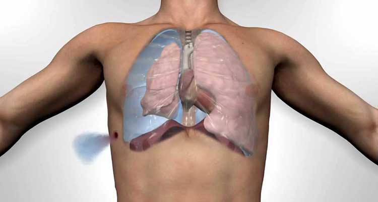 Bu belirti akciğerinizin sönmeye başladığını gösteriyor! Hemen bu testi yapın! 3