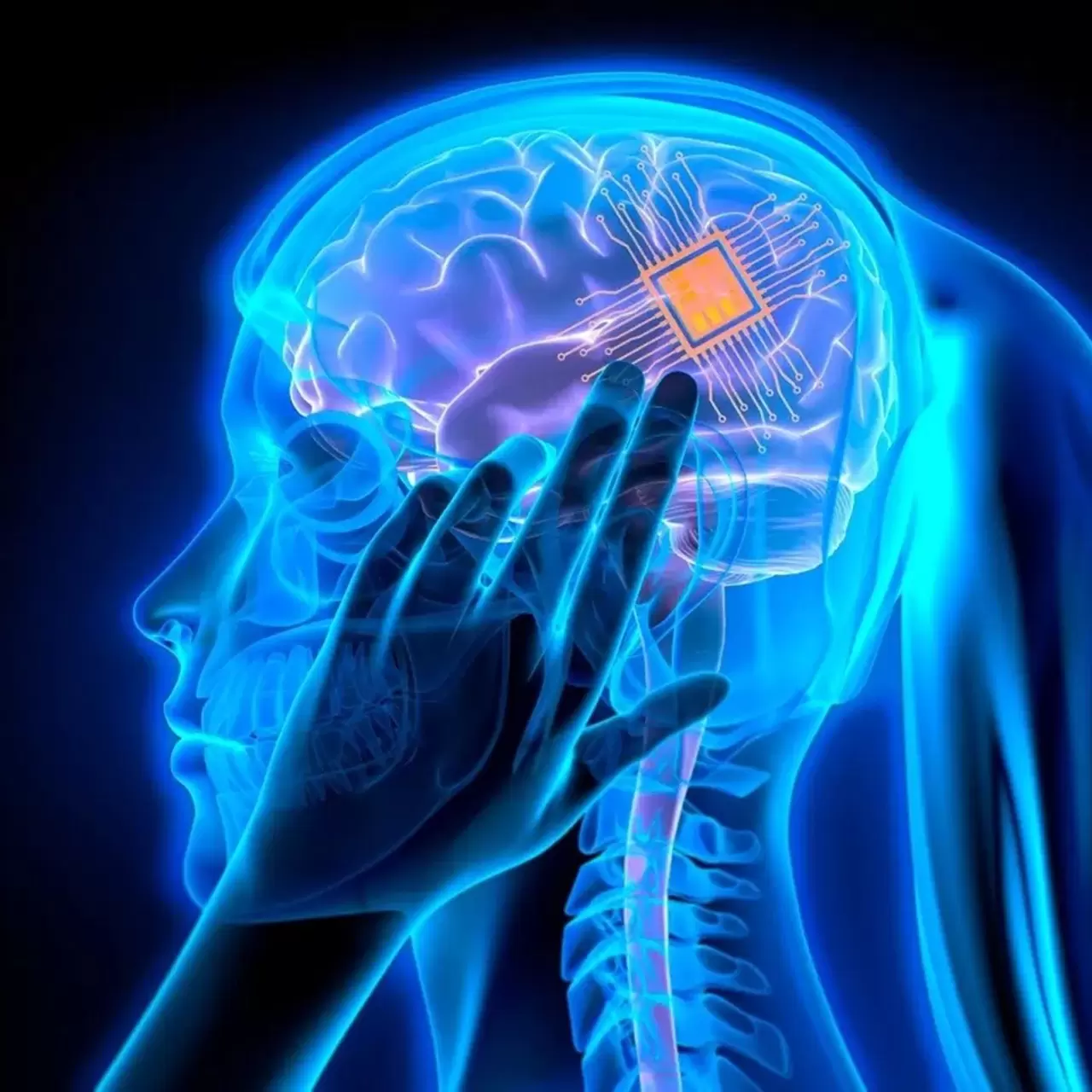 Sessiz tehlike: Beyin implantları bakterilere kapı aralıyor 2