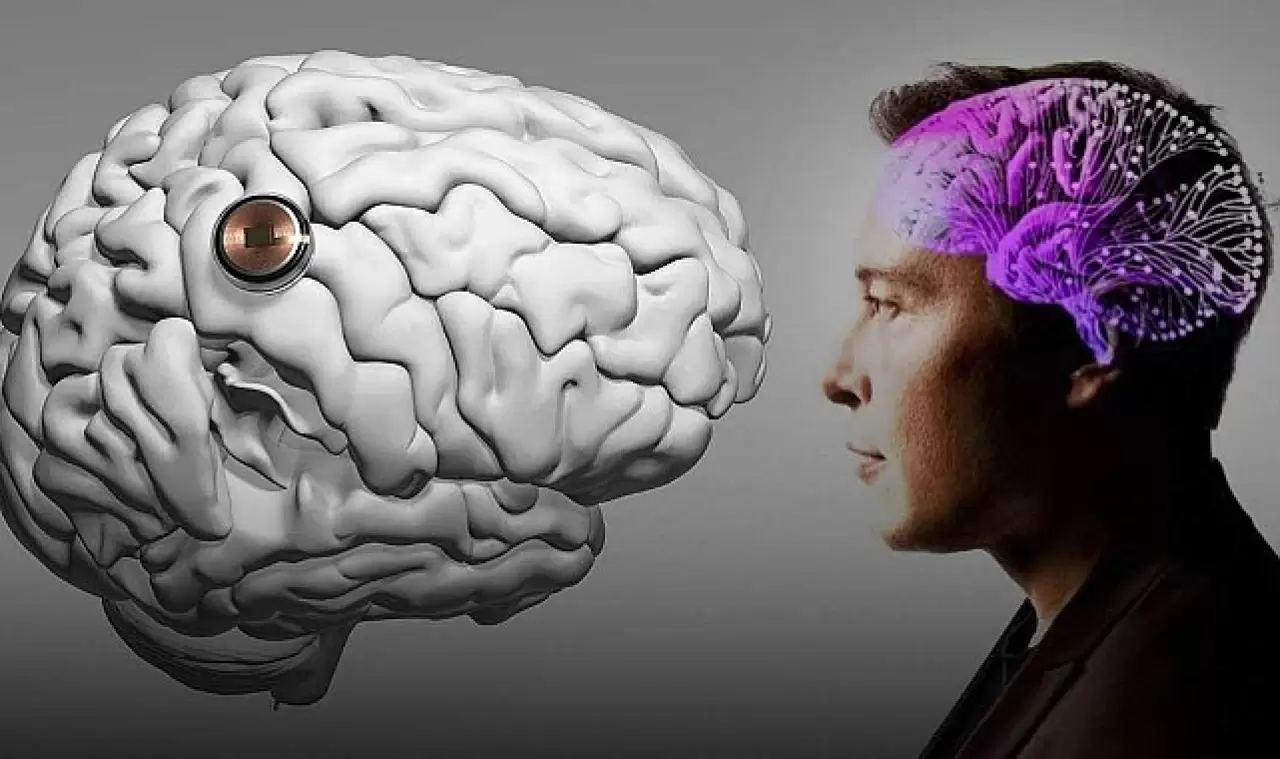 Sessiz tehlike: Beyin implantları bakterilere kapı aralıyor 9