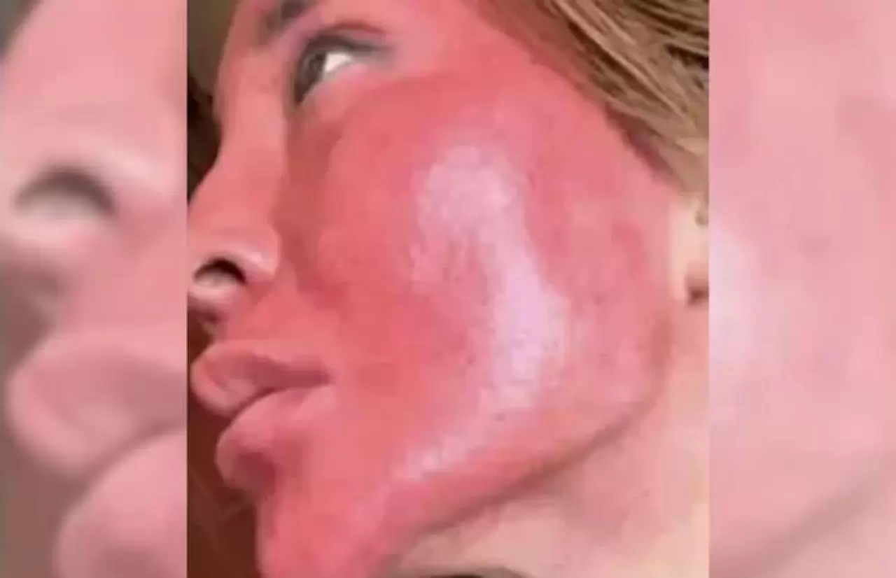 22 yıldır makyajını temizlemeyen kadının son hali şoke etti! 3