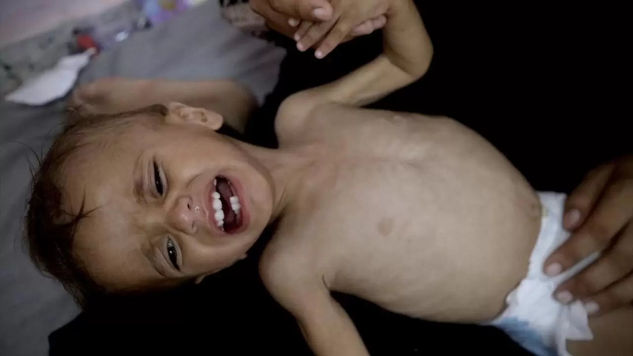 Gazze'de sessiz çığlık! Hastanelerdeki çocuklar adeta ölümü bekliyor 11