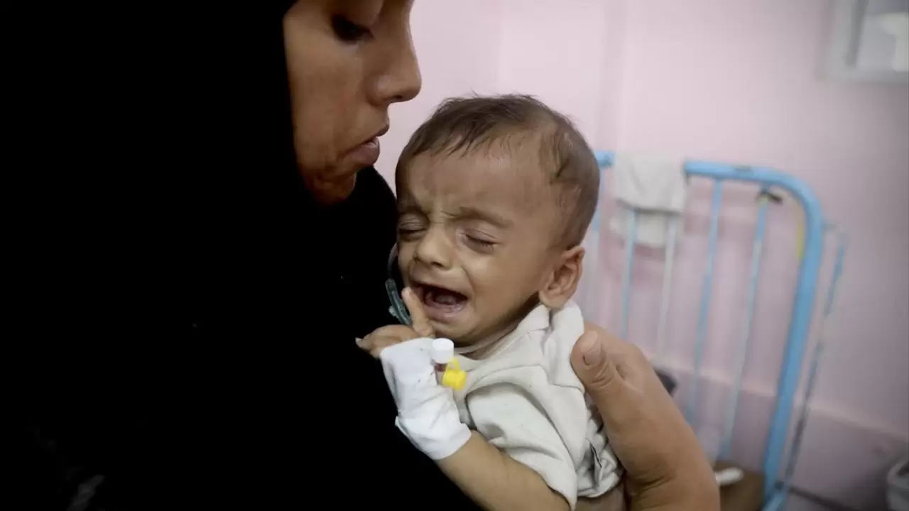 Gazze'de sessiz çığlık! Hastanelerdeki çocuklar adeta ölümü bekliyor 5