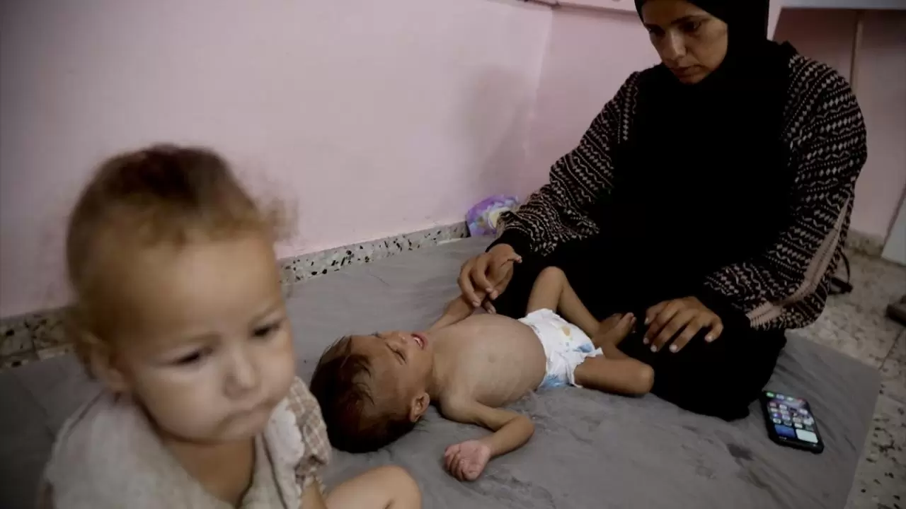 Gazze'de sessiz çığlık! Hastanelerdeki çocuklar adeta ölümü bekliyor 1
