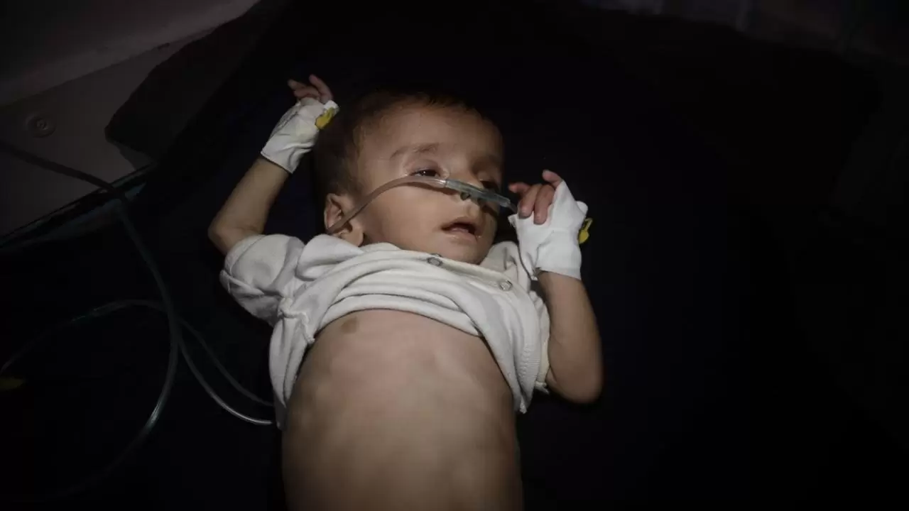 Gazze'de sessiz çığlık! Hastanelerdeki çocuklar adeta ölümü bekliyor 6
