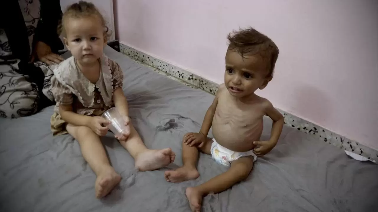 Gazze'de sessiz çığlık! Hastanelerdeki çocuklar adeta ölümü bekliyor 4